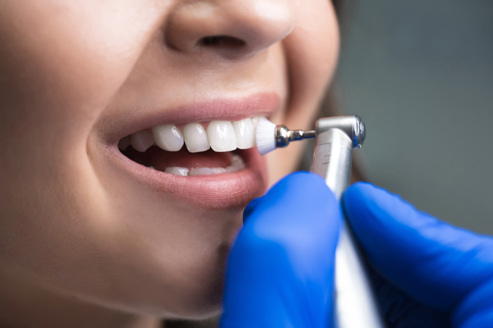 Clinica Dental Dr. Jose A. Velazquez Arroyo (Servicios Cuidado Preventivo)